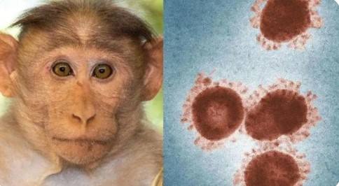 猴痘病毒已发生人际传播还可经由母婴和性传播