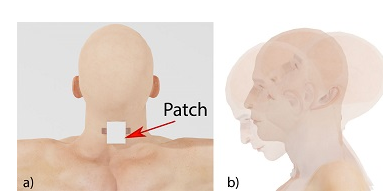 新型可穿戴传感器能检测潜在脑震荡